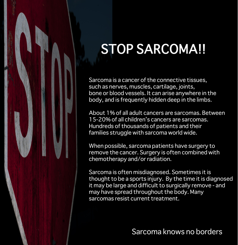 Sarcoma cancer of the lungs. Sarcoma cancer articles